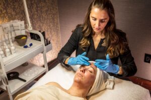 Cool Peels for Skin Renewal: A Gentle Approach to Skin Revitalization