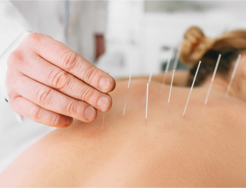 Experience the Benefits of Acupuncture for Seasonal Allergies