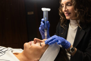 Microneedling: What to Expect, Benefits & Aftercare