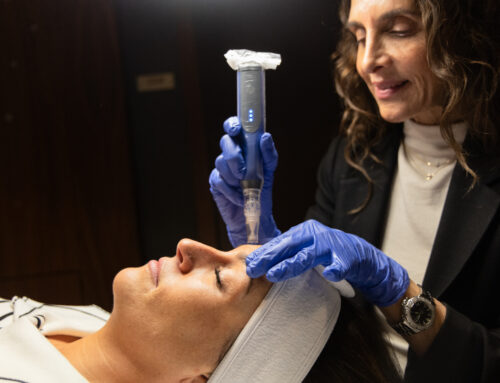 Microneedling: What to Expect, Benefits & Aftercare