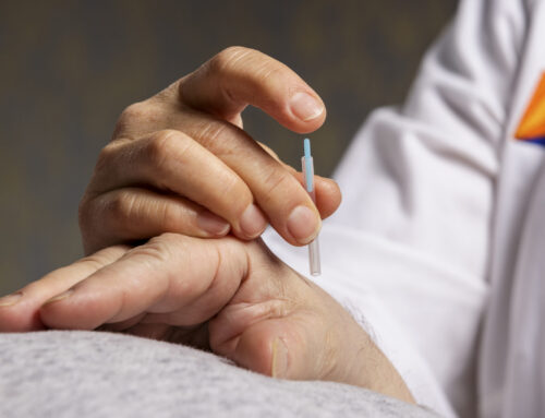 What to Know Before Your First Acupuncture Appointment